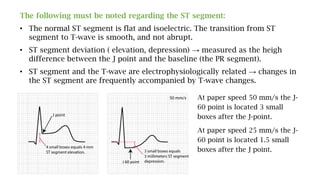 The following must be noted regarding the ST segment:
• The normal ST segment is flat and isoelectric. The transition from ST
segment to T-wave is smooth, and not abrupt.
• ST segment deviation ( elevation, depression) → measured as the heigh
difference between the J point and the baseline (the PR segment).
• ST segment and the T-wave are electrophysiologically related → changes in
the ST segment are frequently accompanied by T-wave changes.
At paper speed 50 mm/s the J-
60 point is located 3 small
boxes after the J-point.
At paper speed 25 mm/s the J-
60 point is located 1.5 small
boxes after the J point.
 