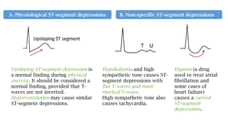 A. Physiological ST-segment depressions B. Non-specific ST-segment depressions
Upsloping ST-segment depression is
a normal finding during physical
exercise. It should be considered a
normal finding, provided that T-
waves are not inverted.
Hyperventilation may cause similar
ST-segment depressions.
Hypokalemia and high
sympathetic tone causes ST-
segment depressions with
flat T-waves and more
marked U-wave.
High sympathetic tone also
causes tachycardia.
Digoxin (a drug
used to treat atrial
fibrillation and
some cases of
heart failure)
causes a curved
ST-segment
depressions.
 