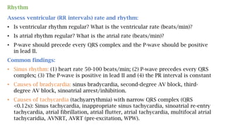 Rhythm
Assess ventricular (RR intervals) rate and rhythm:
• Is ventricular rhythm regular? What is the ventricular rate (beats/min)?
• Is atrial rhythm regular? What is the atrial rate (beats/min)?
• P-wave should precede every QRS complex and the P-wave should be positive
in lead II.
Common findings:
• Sinus rhythm: (1) heart rate 50-100 beats/min; (2) P-wave precedes every QRS
complex; (3) The P-wave is positive in lead II and (4) the PR interval is constant
• Causes of bradycardia: sinus bradycardia, second-degree AV block, third-
degree AV block, sinoatrial arrest/inhibition.
• Causes of tachycardia (tachyarrythmia) with narrow QRS complex (QRS
<0.12s): Sinus tachycardia, inappropriate sinus tachycardia, sinoatrial re-entry
tachycardia, atrial fibrillation, atrial flutter, atrial tachycardia, multifocal atrial
tachycaridia, AVNRT, AVRT (pre-excitation, WPW).
 