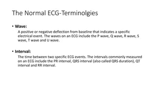 Ecg interpretation