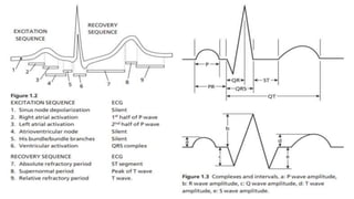Ecg interpretation