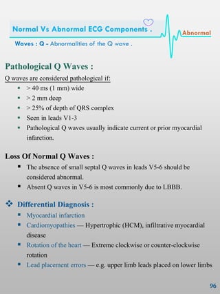 Pathological Q Waves :
Q waves are considered pathological if:
 > 40 ms (1 mm) wide
 > 2 mm deep
 > 25% of depth of QRS complex
 Seen in leads V1-3
 Pathological Q waves usually indicate current or prior myocardial
infarction.
Loss Of Normal Q Waves :
 The absence of small septal Q waves in leads V5-6 should be
considered abnormal.
 Absent Q waves in V5-6 is most commonly due to LBBB.
 Differential Diagnosis :
 Myocardial infarction
 Cardiomyopathies — Hypertrophic (HCM), infiltrative myocardial
disease
 Rotation of the heart — Extreme clockwise or counter-clockwise
rotation
 Lead placement errors — e.g. upper limb leads placed on lower limbs
Waves : Q - Abnormalities of the Q wave .
Normal Vs Abnormal ECG Components . Abnormal
 