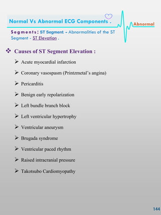  Causes of ST Segment Elevation :
 Acute myocardial infarction
 Coronary vasospasm (Printzmetal‖s angina)
 Pericarditis
 Benign early repolarization
 Left bundle branch block
 Left ventricular hypertrophy
 Ventricular aneurysm
 Brugada syndrome
 Ventricular paced rhythm
 Raised intracranial pressure
 Takotsubo Cardiomyopathy
S e gmen ts : ST Segment - Abnormalities of the ST
Segment - ST Elevation .
Normal Vs Abnormal ECG Components . Abnormal
 