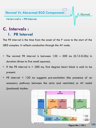 C. Intervals :
1. PR Interval
The PR interval is the time from the onset of the P wave to the start of the
QRS complex. It reflects conduction through the AV node.
• The normal PR interval is between 120 – 200 ms (0.12-0.20s) in
duration (three to five small squares).
• If the PR interval is > 200 ms, first degree heart block is said to be
present.
• PR interval < 120 ms suggests pre-excitation (the presence of an
accessory pathway between the atria and ventricles) or AV nodal
(junctional) rhythm.
In ter vals : PR Interval .
Normal Vs Abnormal ECG Components . Normal
Figure No ( 193 )
 