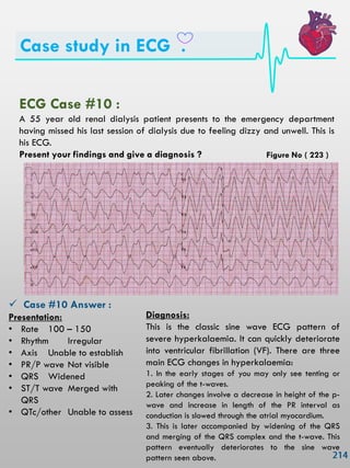 Case study in ECG .
ECG Case #10 :
A 55 year old renal dialysis patient presents to the emergency department
having missed his last session of dialysis due to feeling dizzy and unwell. This is
his ECG.
Present your findings and give a diagnosis ?
 Case #10 Answer :
Presentation:
• Rate 100 – 150
• Rhythm Irregular
• Axis Unable to establish
• PR/P wave Not visible
• QRS Widened
• ST/T wave Merged with
QRS
• QTc/other Unable to assess
Diagnosis:
This is the classic sine wave ECG pattern of
severe hyperkalaemia. It can quickly deteriorate
into ventricular fibrillation (VF). There are three
main ECG changes in hyperkalaemia:
1. In the early stages of you may only see tenting or
peaking of the t-waves.
2. Later changes involve a decrease in height of the p-
wave and increase in length of the PR interval as
conduction is slowed through the atrial myocardium.
3. This is later accompanied by widening of the QRS
and merging of the QRS complex and the t-wave. This
pattern eventually deteriorates to the sine wave
pattern seen above.
Figure No ( 223 )
 