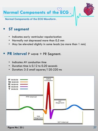  ST segment
• Indicates early ventricular repolarization
• Normally not depressed more than 0.5 mm
• May be elevated slightly in some leads (no more than 1 mm)
 PR interval P wave + PR Segment.
• Indicates AV conduction time
• Duration time is 0.12 to 0.20 seconds
• Duration: 3-5 small squares/120-220 ms
Normal Components of the ECG Waveform .
Normal Components of the ECG .
Figure No ( 23 )
 