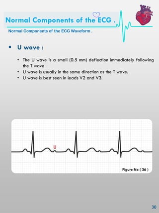  U wave :
• The U wave is a small (0.5 mm) deflection immediately following
the T wave
• U wave is usually in the same direction as the T wave.
• U wave is best seen in leads V2 and V3.
Normal Components of the ECG Waveform .
Normal Components of the ECG .
Figure No ( 26 )
 
