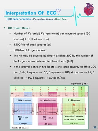 Ecg interpretation | PDF