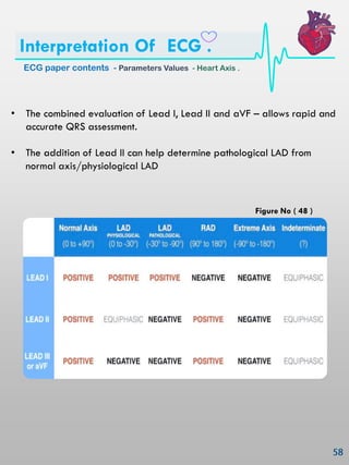 • The combined evaluation of Lead I, Lead II and aVF – allows rapid and
accurate QRS assessment.
• The addition of Lead II can help determine pathological LAD from
normal axis/physiological LAD
ECG paper contents - Parameters Values - Heart Axis .
Interpretation Of ECG .
Figure No ( 48 )
 