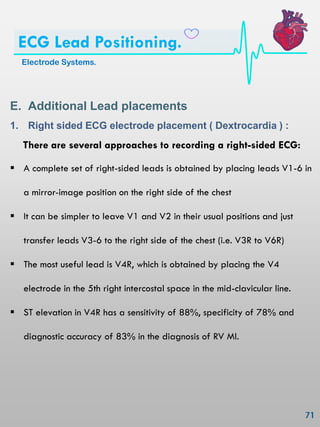 E. Additional Lead placements
1. Right sided ECG electrode placement ( Dextrocardia ) :
There are several approaches to recording a right-sided ECG:
 A complete set of right-sided leads is obtained by placing leads V1-6 in
a mirror-image position on the right side of the chest
 It can be simpler to leave V1 and V2 in their usual positions and just
transfer leads V3-6 to the right side of the chest (i.e. V3R to V6R)
 The most useful lead is V4R, which is obtained by placing the V4
electrode in the 5th right intercostal space in the mid-clavicular line.
 ST elevation in V4R has a sensitivity of 88%, specificity of 78% and
diagnostic accuracy of 83% in the diagnosis of RV MI.
Electrode Systems.
ECG Lead Positioning.
 