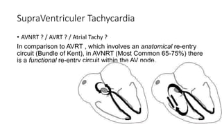 Ecg interpretation , Upgraded | PPTX