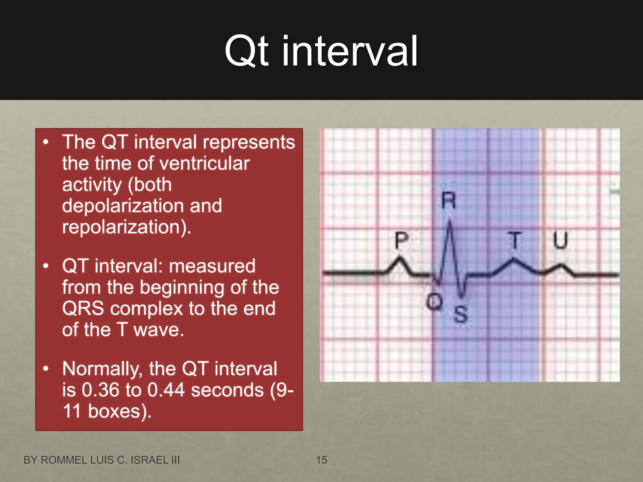 Qt interval
• The QT interval represents
the time of ventricular
activity (both
depolarization and
repolarization).
• QT interval: measured
from the beginning of the
QRS complex to the end
of the T wave.
• Normally, the QT interval
is 0.36 to 0.44 seconds (9-
11 boxes).
BY ROMMEL LUIS C. ISRAEL III 15
 