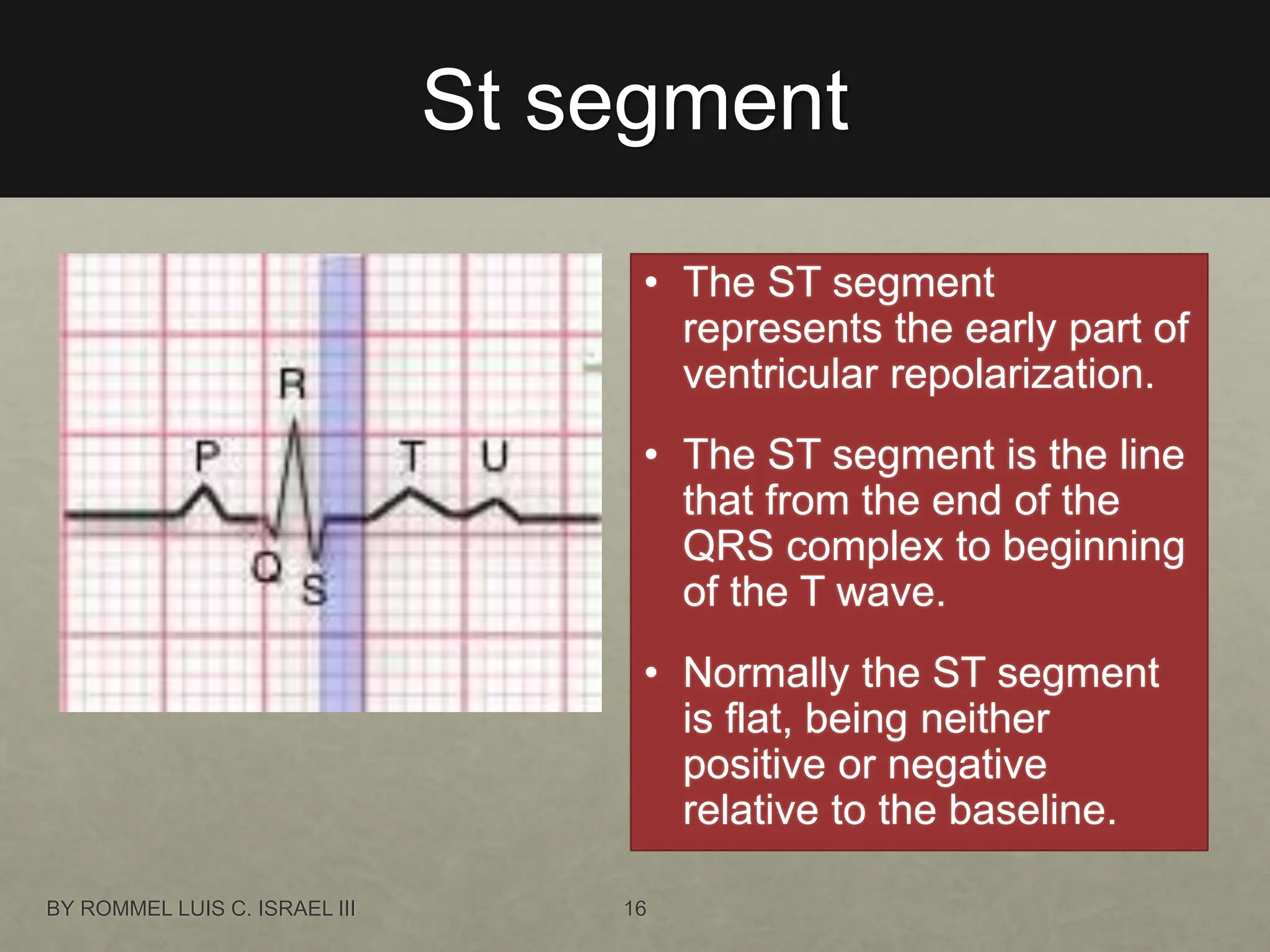 St segment
• The ST segment
represents the early part of
ventricular repolarization.
• The ST segment is the line
that from the end of the
QRS complex to beginning
of the T wave.
• Normally the ST segment
is flat, being neither
positive or negative
relative to the baseline.
BY ROMMEL LUIS C. ISRAEL III 16
 