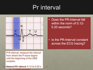 ECG Interpretation | PPTX image.