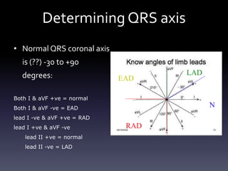 Determining QRS axis
• Normal QRS coronal axis
is (??) -30 to +90
degrees:
Both I & aVF +ve = normal
Both I & aVF -ve = EAD
lead I -ve & aVF +ve = RAD
lead I +ve & aVF -ve
lead II +ve = normal
lead II -ve = LAD
N
RAD
LAD
EAD
 