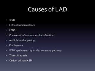 Causes of LAD
• ?LVH
• Left anterior hemiblock
• LBBB
• Q waves of inferior myocardial infarction
• Artificial cardiac pacing
• Emphysema
• WPW syndrome - right sided accessory pathway
• Tricuspid atresia
• Ostium primum ASD
 