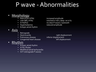 P wave - Abnormalities
• Morphology
• RAH (Pulm HTN) increased amplitude
• LAH (MS, HTN) notched in I & II, deep -ve inV1
• A Fib/Flut no clear P waves / sawtooth
• Hyperkalaemia reduced amplitude
• Ectopic atrial rhythm
• Axis
• Retrograde
• Dextrocardia right displacement
• Pulmonary disease inferior displacement
• Congenital heart disease left displacement
• Rhythm
• Ectopic atrial rhythm
• A Fib / flutter
• Multifocal atrial tachycardia
• SVT (retrograde P waves)
 