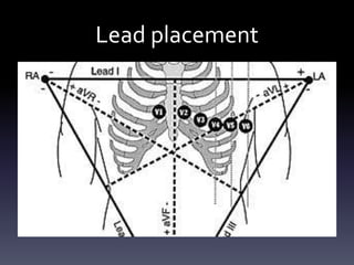 Lead placement
 