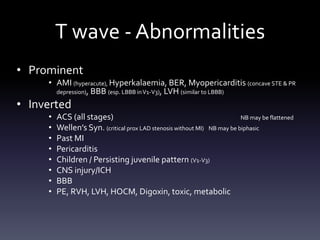 T wave - Abnormalities
• Prominent
• AMI (hyperacute), Hyperkalaemia, BER, Myopericarditis (concave STE & PR
depression), BBB (esp. LBBB inV1-V3), LVH (similar to LBBB)
• Inverted
• ACS (all stages) NB may be flattened
• Wellen’s Syn. (critical prox LAD stenosis without MI) NB may be biphasic
• Past MI
• Pericarditis
• Children / Persisting juvenile pattern (V1-V3)
• CNS injury/ICH
• BBB
• PE, RVH, LVH, HOCM, Digoxin, toxic, metabolic
 