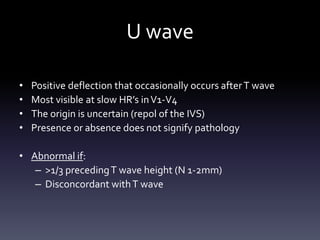 U wave
• Positive deflection that occasionally occurs afterT wave
• Most visible at slow HR’s inV1-V4
• The origin is uncertain (repol of the IVS)
• Presence or absence does not signify pathology
• Abnormal if:
– >1/3 precedingT wave height (N 1-2mm)
– Disconcordant withT wave
 