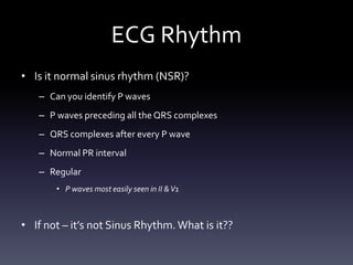 ECG Rhythm
• Is it normal sinus rhythm (NSR)?
– Can you identify P waves
– P waves preceding all the QRS complexes
– QRS complexes after every P wave
– Normal PR interval
– Regular
• P waves most easily seen in II &V1
• If not – it’s not Sinus Rhythm. What is it??
 