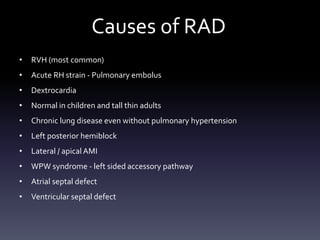Causes of RAD
• RVH (most common)
• Acute RH strain - Pulmonary embolus
• Dextrocardia
• Normal in children and tall thin adults
• Chronic lung disease even without pulmonary hypertension
• Left posterior hemiblock
• Lateral / apical AMI
• WPW syndrome - left sided accessory pathway
• Atrial septal defect
• Ventricular septal defect
 