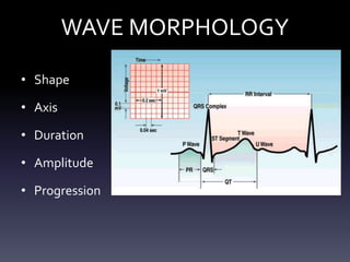 WAVE MORPHOLOGY
• Shape
• Axis
• Duration
• Amplitude
• Progression
 