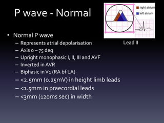 P wave - Normal
• Normal P wave
– Represents atrial depolarisation
– Axis 0 – 75 deg
– Upright monophasic I, II, III and AVF
– Inverted in AVR
– Biphasic inV1 (RA bf LA)
– <2.5mm (0.25mV) in height limb leads
– <1.5mm in praecordial leads
– <3mm (120ms sec) in width
Lead II
 