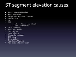 ST segment elevation causes:
• AcuteCoronary Syndrome
• Acute pericarditis
• Benign early repolarisation (BER)
• LV aneurysm
• LVH
• BBB
• Left - R to mid precordial leads
• Right - lateral leads
• Cardiomyopathy
• Acute myocarditis
• Hypothermia
• Hyperkalaemia
• Myocardial contusion
• CNS injury
• Brugarda Syn
• Paced vent. Rhythms
• Post-electrical cardioversion
 