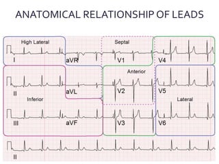 ANATOMICAL RELATIONSHIP OF LEADS
 