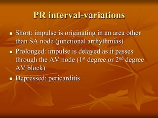 ECG Interpretation ECG Interpretation Basics & Quick Guide ( PDFDrive ).pdf
