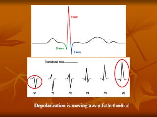 ECG Interpretation ECG Interpretation Basics & Quick Guide ( PDFDrive ).pdf