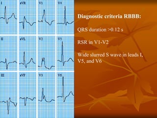 ECG Interpretation ECG Interpretation Basics & Quick Guide ( PDFDrive ).pdf