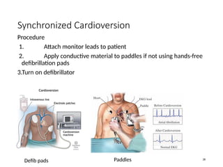 ECG/EKG INTERPRETATION FOR HOUSE OFFICERS | PPTX