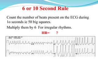 Electrocardiography (ECG)interpretation .ppt