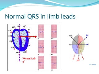 Electrocardiography (ECG)interpretation .ppt