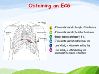 Obtaining an ECG
 