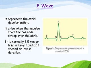 P Wave
it represent the atrial
depolarization.
it arise when the impulse
from the SA node
sweep over the atria.
It is normally 2.5 mm or
less in height and 0.11
second or less in
duration.
 