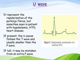 U wave
It represent the
repolarisation of the
purkinje fibres, but
sometime seen in patient
with hypokalemia, HTN,
heart disease.
If present, the U waves
follows the T wave and
usually smaller then the
P wave.
If tall, it may be mistaken
from an extra P wave.
 