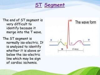 ST Segment
The end of ST segment is
very difficult to
identify because it
merge into the T wave.
The ST segment is
normally iso-electric. It
is analyzed to identify
whether it is above or
below the iso-electric
line which may be sign
of cardiac ischemia.
 