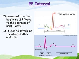 PP Interval
It measured from the
beginning of P Wave
to the beginning of
next P wave.
It is used to determine
the atrial rhythm
and rate.
 
