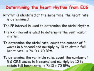 Determining the heart rhythm from ECG
Rhythm is identified at the same time, the heart rate
is determined.
The PP interval is used to determine the atrial rhythm.
The RR interval is used to determine the ventricular
rhythm
To determine the atrial rate, count the number of P
waves in 6 second and multiply by 10 to obtain full
heart rate. = 7x10 = 70 BPM
To determine the ventricle rate, count the number of
R & QRS waves in 6 second and multiply by 10 to
obtain full heart rate. = 7x10 = 70 BPM
 