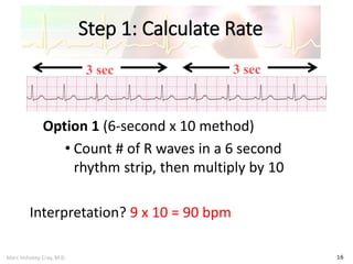 Marc Imhotep Cray, M.D.
Step 1: Calculate Rate
16
Option 1 (6-second x 10 method)
• Count # of R waves in a 6 second
rhythm strip, then multiply by 10
Interpretation? 9 x 10 = 90 bpm
3 sec 3 sec
 