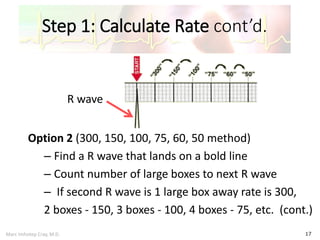 Marc Imhotep Cray, M.D.
Step 1: Calculate Rate cont’d.
17
Option 2 (300, 150, 100, 75, 60, 50 method)
– Find a R wave that lands on a bold line
– Count number of large boxes to next R wave
– If second R wave is 1 large box away rate is 300,
2 boxes - 150, 3 boxes - 100, 4 boxes - 75, etc. (cont.)
R wave
 