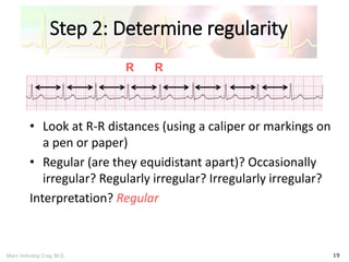 Marc Imhotep Cray, M.D.
Step 2: Determine regularity
19
• Look at R-R distances (using a caliper or markings on
a pen or paper)
• Regular (are they equidistant apart)? Occasionally
irregular? Regularly irregular? Irregularly irregular?
Interpretation? Regular
R R
 