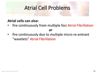 Marc Imhotep Cray, M.D.
Atrial Cell Problems
25
Atrial cells can also:
• fire continuously from multiple foci Atrial Fibrillation
or
• fire continuously due to multiple micro re-entrant
“wavelets” Atrial Fibrillation
 