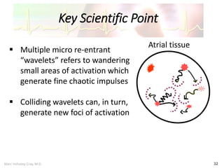 Marc Imhotep Cray, M.D.
Key Scientific Point
32
Atrial tissue
 Multiple micro re-entrant
“wavelets” refers to wandering
small areas of activation which
generate fine chaotic impulses
 Colliding wavelets can, in turn,
generate new foci of activation
 