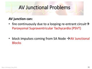 Marc Imhotep Cray, M.D.
AV Junctional Problems
33
AV junction can:
• fire continuously due to a looping re-entrant circuit
Paroxysmal Supraventricular Tachycardia (PSVT)
• block impulses coming from SA Node AV Junctional
Blocks
 