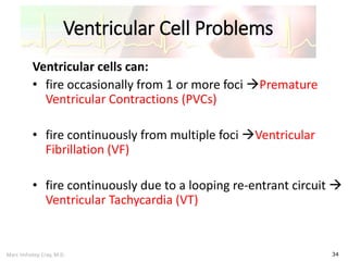 Marc Imhotep Cray, M.D.
Ventricular Cell Problems
34
Ventricular cells can:
• fire occasionally from 1 or more foci Premature
Ventricular Contractions (PVCs)
• fire continuously from multiple foci Ventricular
Fibrillation (VF)
• fire continuously due to a looping re-entrant circuit 
Ventricular Tachycardia (VT)
 