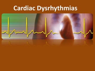 Cardiac Dysrhythmias
 